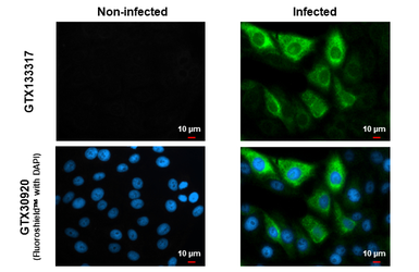 Anti-Zika virus Capsid protein antibody used in Immunocytochemistry/ Immunofluorescence (ICC/IF). GTX133317